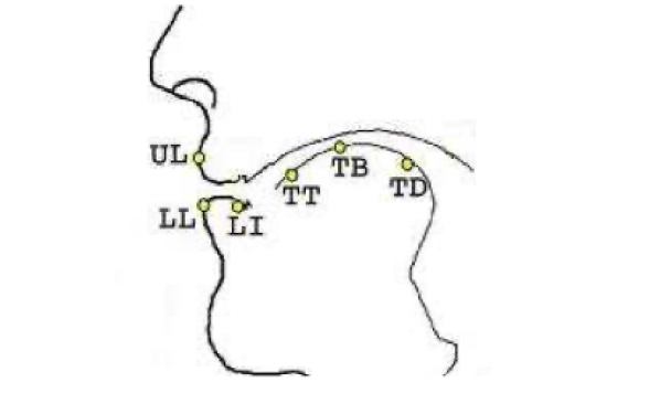 Comparison of speech quality with and without sensors in electromagnetic articulograph AG 501 recording