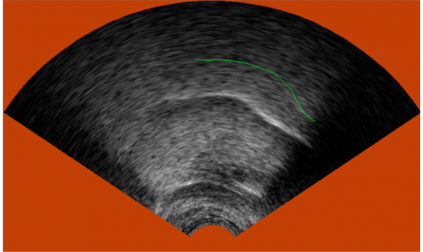A Comparison of Methods for Tongue Shape Analysis
