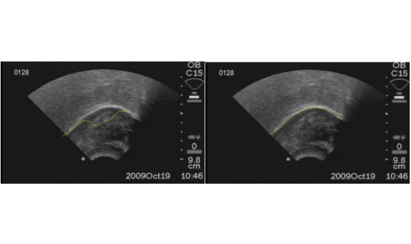 Statistical analysis of tongue shape in ultrasound video sequences: tongue tracking and population analysis