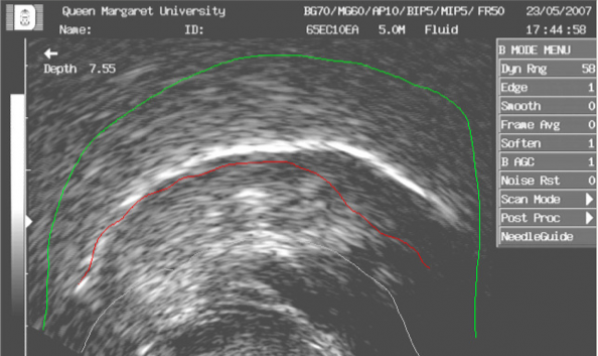 An ultrasound study of Mandarin fricatives and affricate consonants