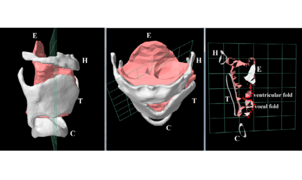 Ultrasound images in the new ‘iPA Phonetics’ App