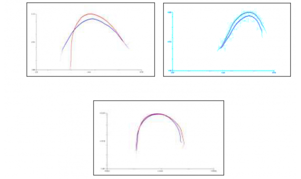 An ultrasound study of oral and nasal central vowels in Brazilian Portuguese