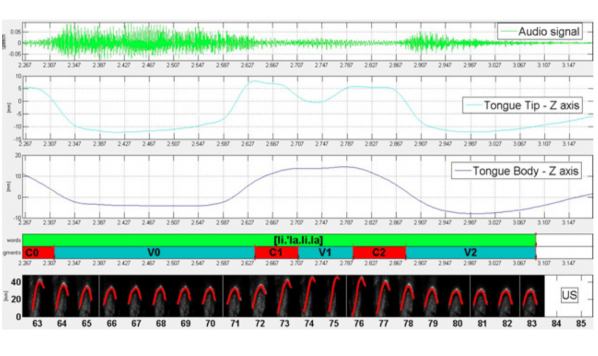 A New Head-Probe Stabilization Device for synchronized Ultrasound and Electromagnetic Articulography recordings