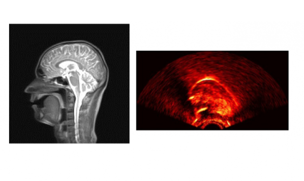 Ultrax: Vocal Tract Imaging for Speech Therapy and Research