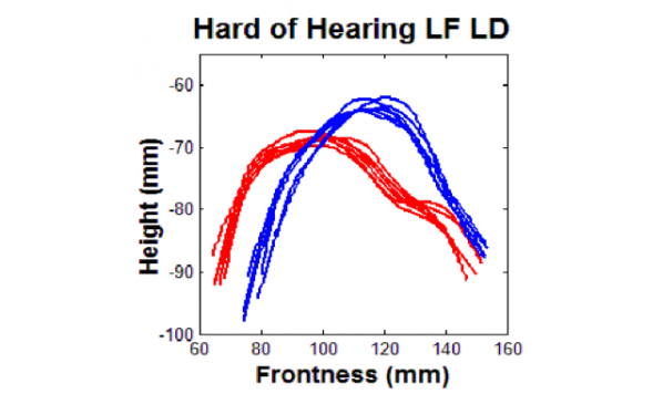 Factors affecting the articulatory and acoustic characteristics of vowels in clear speech