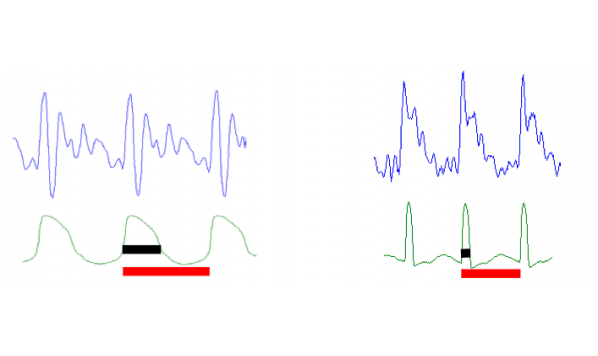 Measuring voice in the clinic-Laryngograph Speech Studio Analyses