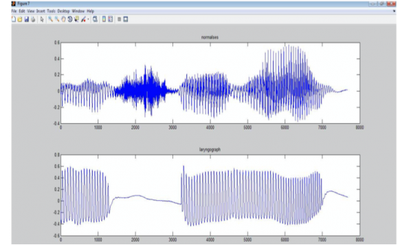 VOICED-UNVOICED CLASSIFICATION OF SPEECH USING AUTOCORRELATION MATRIX
