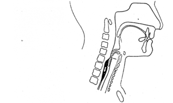 NON-INVASIVE MONITORING OF REFLEXIVE SWALLOWING
