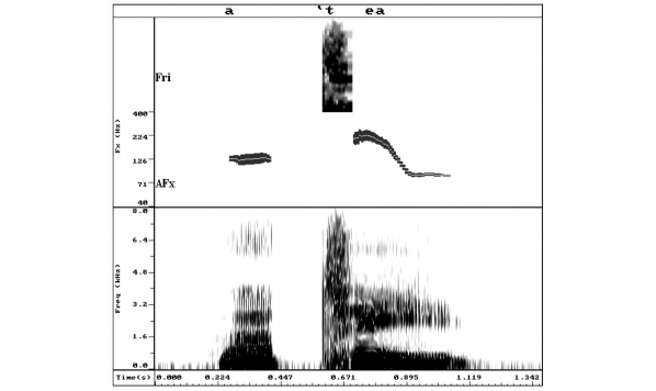 REAL-TIME SPEECH PATTERN ELEMENT DISPLAYS FOR INTERACTIVE THERAPY