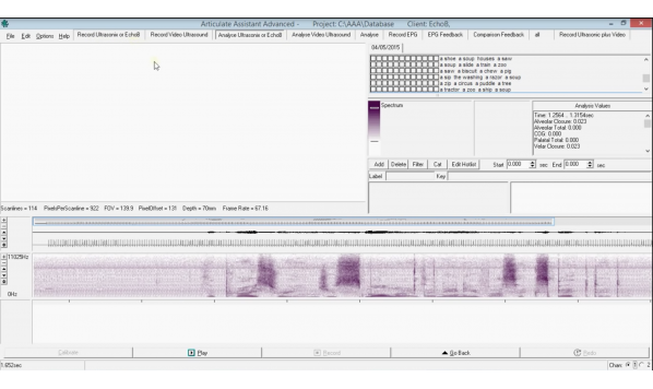 Tutorial 3- Annotations and Splines