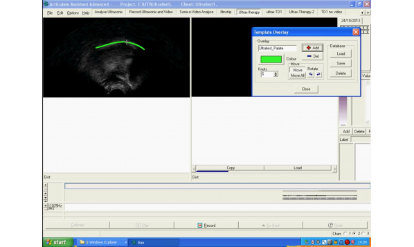 Tutorial 7- Recording Ultrasound Data (Legacy)