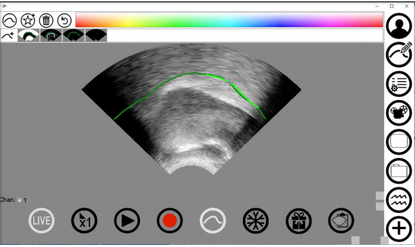 Automatic palate trace