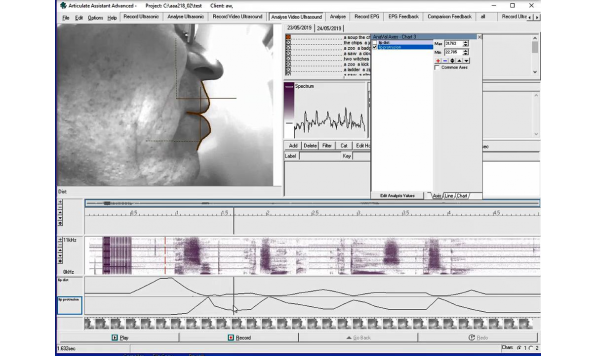 Image analysis tutorial 7 How to measure lip protrusion