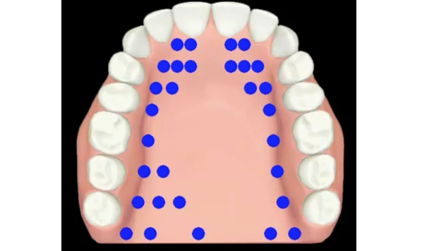 LinguaGraph（EPG）