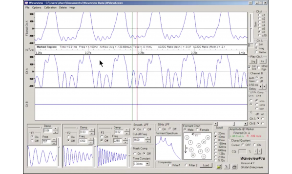 Waveview Inverse Filtering 5