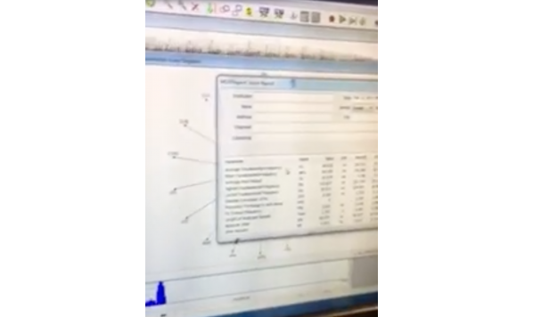 MDVP, Sustained Vowel