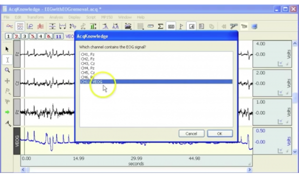 EEG - EOG伪影去除