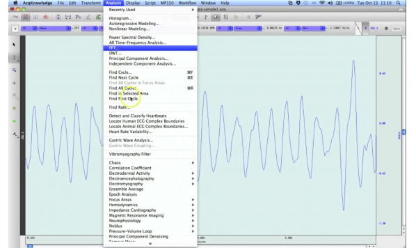 Gastric Wave Analysis