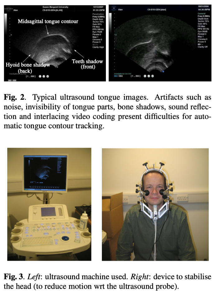 Predicting tongue shapes from a few landmark locations-LingLab