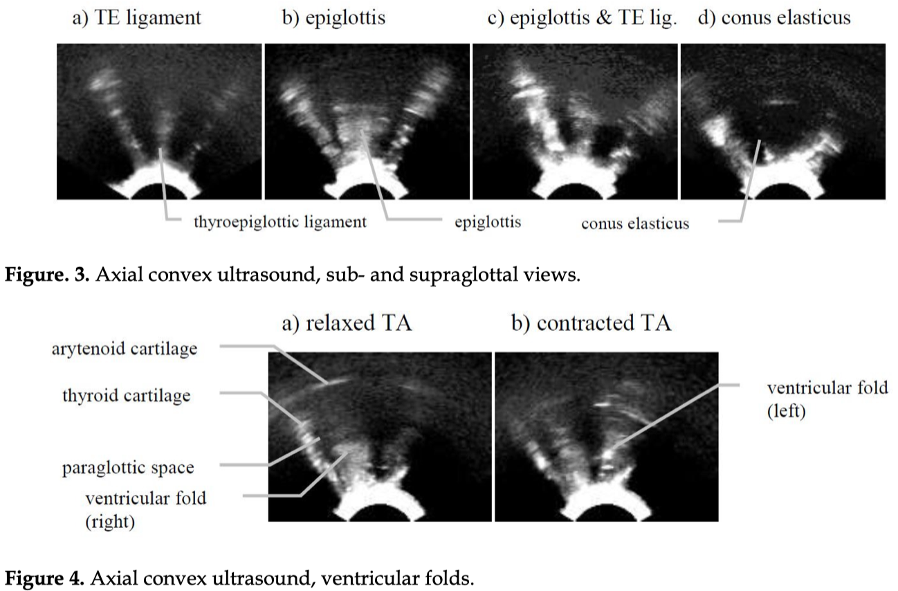 Ultrasound images in the new ‘iPA Phonetics’ App-LingLab