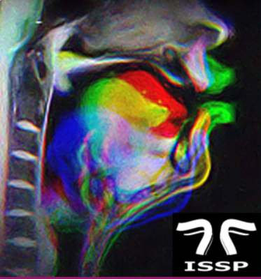 578b431f82af456438788e724bb7823.png