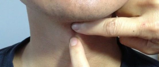 你的有些习惯，正在毁掉你的嗓音！ ——来自美国权威嗓音专家的指导